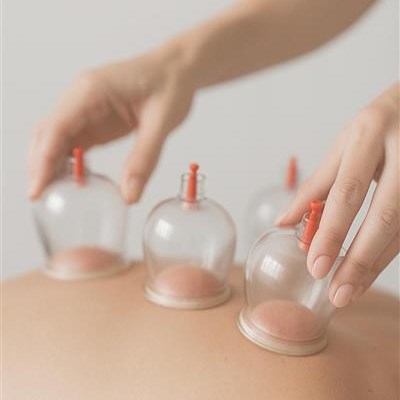 The Healing Power of Cupping: Why This Ancient Therapy Still Matters